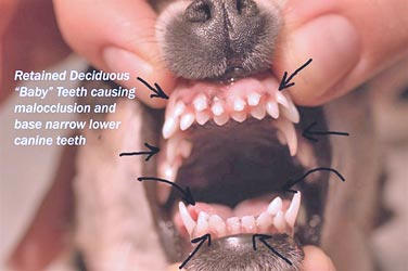 Retained deciduous "baby" teeth causing problems