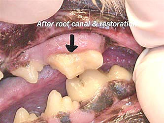 After root canal & restoration