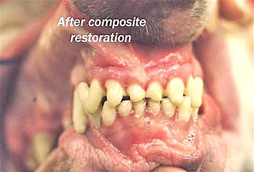 After composit restoration